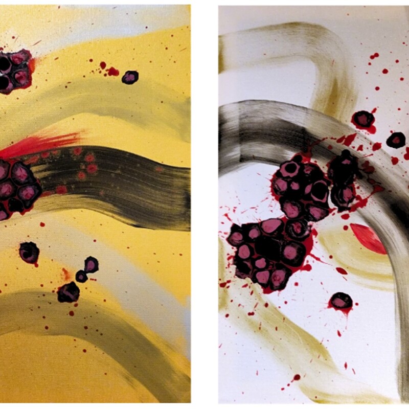 “Emergences” exists as two separate canvases, yet together they are one. While each canvas holds its own presence, one grounded in gold, the other in silver, together, their portrait forms shift into a landscape, creating a sense of two halves belonging to the same whole.
The work emerged from an exploration of frustration, as an energy that moves through us, disrupting familiar patterns and creating the conditions for something new to emerge. It is the moment when thoughts, feelings and actions begin moving in different directions, and something within us can no longer remain as it was.
Across both canvases, thick, expressive lines of black, gold and silver move with force and direction, connecting one surface to the other. Black dominates, representing the line of pure consciousness, the universe that is always present, holding and moving through everything.
Within the black forms, cellular shapes appear, resembling red blood cells suspended within the darkness. They sit apart, yet they are never truly separate. The space between them is not empty. It is the universe itself, the space through which everything is held, connected and continually in motion. Our human bodies, too, exist within this greater field of connection.
There is a sense of disruption here. Of things breaking down, dispersing, and recoagulating. Familiar forms lose their cohesion before new possibilities begin to take shape. I could not say whether the movement is from gold to silver or silver to gold, because ultimately the two continually feed back into one another. There is no clear beginning or end, only movement, transition and return.
Perhaps this is what transformation looks like from within: A breaking apart. A reorganisation. A moment of frustration becoming a doorway into awareness and to awakening. And somewhere within the disruption, something new begins to emerge.
